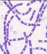 Bacillus anthracis