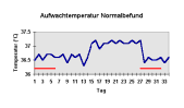 Beispiel einer (normalen) Temperaturkurve