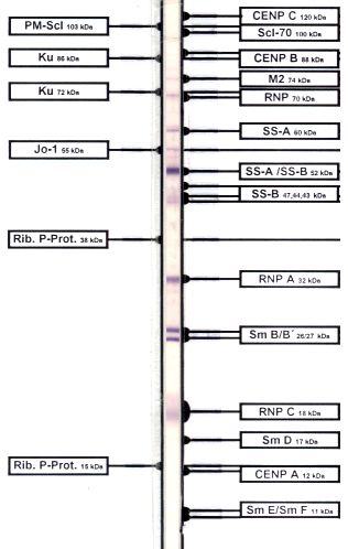 Western-Blot-Streifen