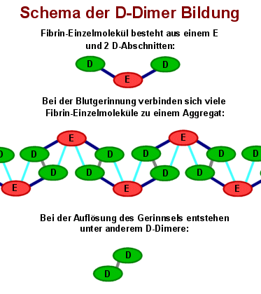 Bei d-dimere erkältung erhöht Thrombose: Diese