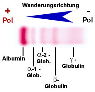 Eiweielektrophorese nach Auftrennung und Frbung