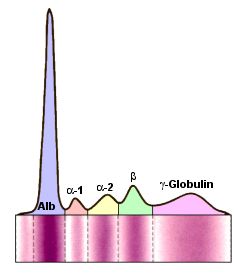 Elektrophoresekurve