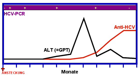 hcv_verlauf.gif (11382 Byte)