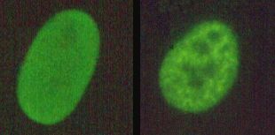 Beispiel zweier verschiedener Muster in der Immunfluoreszenz