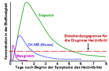 Verlauf wichtiger "Herzmarker" bei einem Herzinfarkt