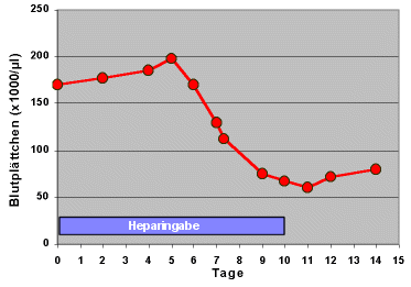Beispiel des Verlaufs der Zahl der Blutplttchen bei HIT