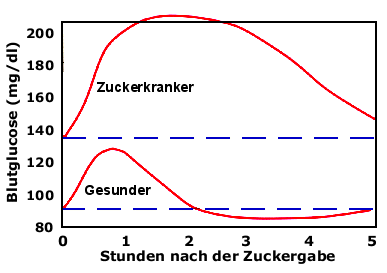 Blutzuckspiegelverlauf nach Blutzucker-Belastungsprobe