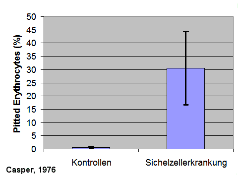 Pitted Erythrozyten bei Sichelzellanmie stark erhht