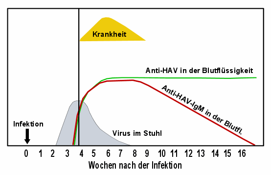 Graphische Darstellung der Befunde bei Hepatitis A