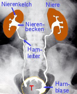 Urographie: Kontrastmitteluntersuchung der Niere; Schema