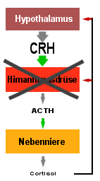 Sekundre Nebennieren-Insuffizienz: Erkrankungen der Hirnanhangsdrse (Hypophyse) sind die Ursache