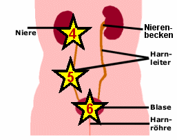 Ursachen einer Proteinurie "nach der Niere", d.h. nach Nierenfilter und Nierenröhrchen