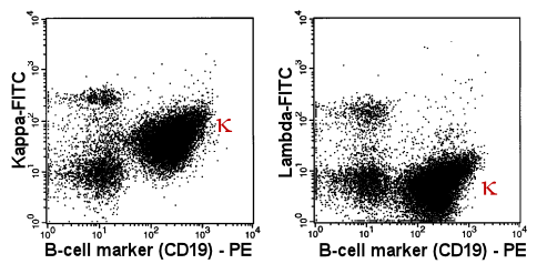 Monoclonal B-cells, double stained with anti-CD19-PE and anti-light chain-FITC