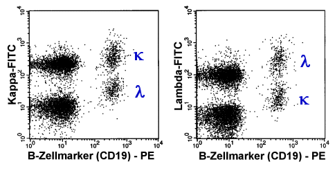 Polyklonale B-Zellen nach Doppelfrbung CD19 und Leichtkette