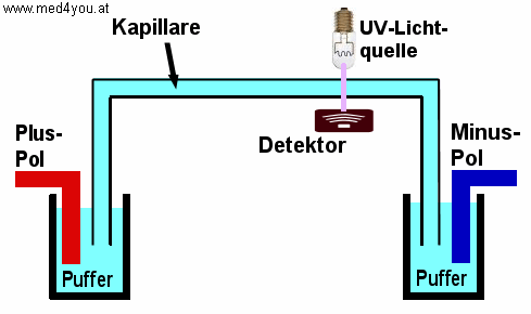 Schema des Aufbaus einer Kapillar-Elektrophorese