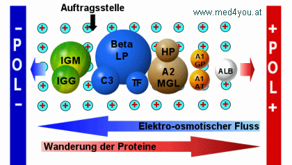 Die am schwchsten wandernden Globuline, die Gamma-Globuline, hat der EOF Richtung Minus-Pol mitgenommen.