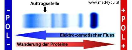 Bei der Agarose-Gel Elektrophorese wandern die Gamma-Globuline Richtung Minus-Pol.