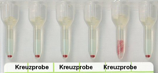 Vertrgliche und unvertrgliche Kreuzprobe