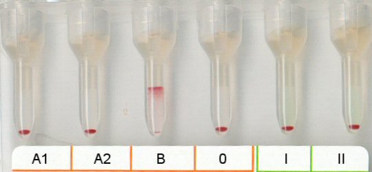 Serumgegenprobe Blutgruppe A