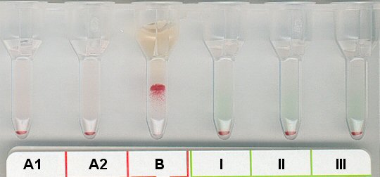 Serumgegenprobe Blutgruppe A