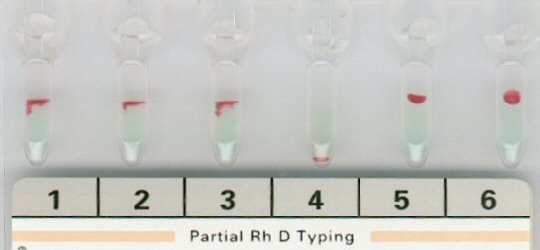Partial-Rh-D-Typing