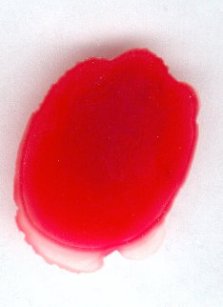 Negative Reaktion von roten Blutkörperchen auf einer Glasplatte