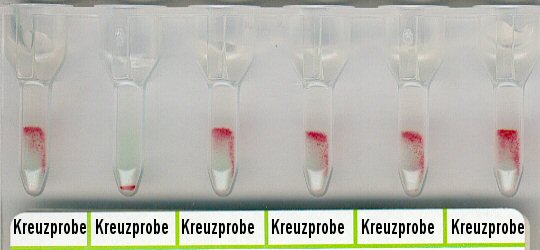 Unvertrgliche und vertrgliche Kreuzproben