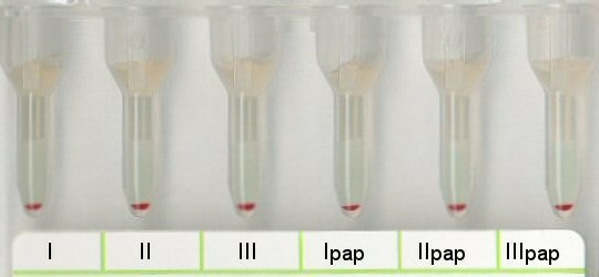 Negatives Antikrper-Screening