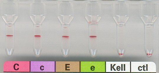 Rhesusuntergruppe CcEe, Kell negativ