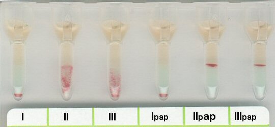 Positives Antikrper-Screening bei 37 C