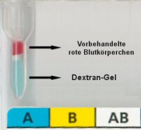 Pipettierschema fr Blutgruppen- und Rhesuskarte