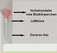 Pipettierschema fr den Direkten Coombstest (DCT)