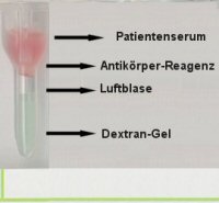 Pipettierschema fr den Indirekten Coombstest (ICT)