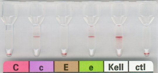 Rhesusuntergruppe ccee, Kell positiv